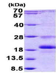SDS-PAGE - Recombinant Human Id1 protein (AB156711), expandable thumbnail