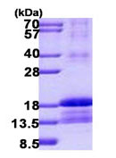SDS-PAGE - Recombinant Human ID2 protein (denatured) (AB140586), expandable thumbnail