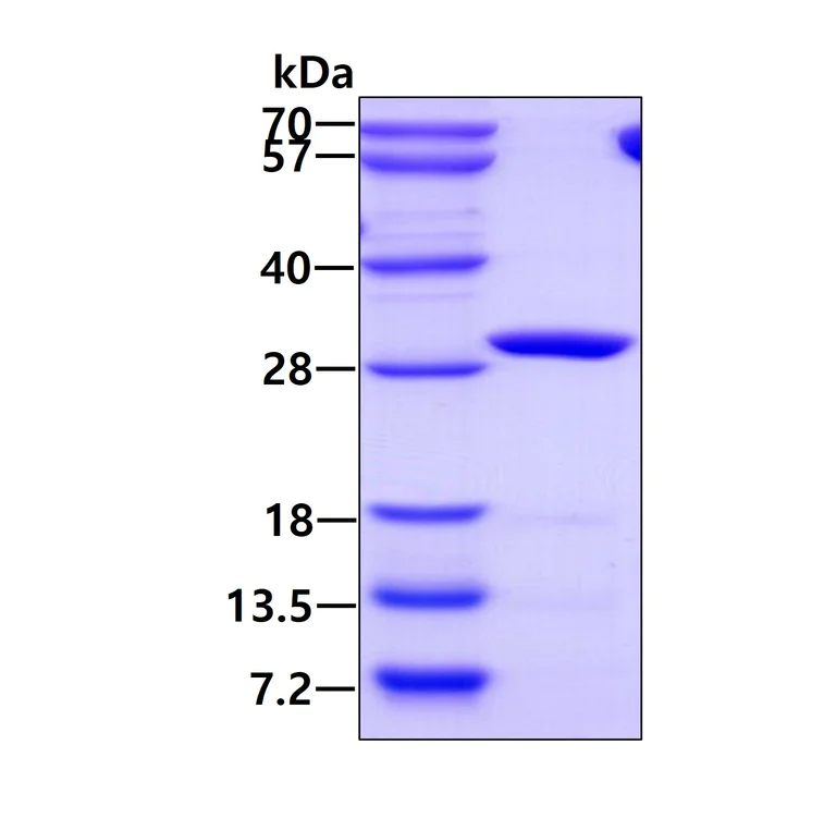 SDS-PAGE - Recombinant Human IDI1 protein (AB113598)