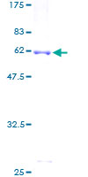 Recombinant Human Iduronate 2 sulfatase/SIDS protein