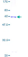 SDS-PAGE - Recombinant Human Iduronate 2 sulfatase/SIDS protein (GST tag N-Terminus) (AB158721)