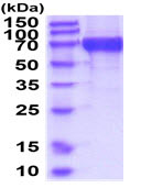 SDS-PAGE - Recombinant Human Iduronate 2 sulfatase/SIDS protein (His tag) (AB219294), expandable thumbnail
