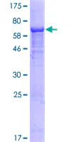 SDS-PAGE - Recombinant Human IFI44L protein (GST tag N-Terminus) (AB161220)