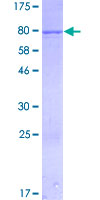 SDS-PAGE - Recombinant Human IFIT1 protein (AB152468)