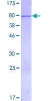 SDS-PAGE - Recombinant Human IFIT1 protein (AB152468)