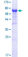 SDS-PAGE - Recombinant Human IFIT2 protein (AB132593)