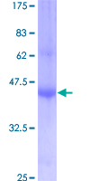 Recombinant Human IFITM1 protein