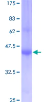 SDS-PAGE - Recombinant Human IFITM1 protein (AB152882)