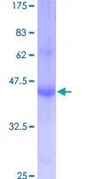 SDS-PAGE - Recombinant Human IFITM1 protein (GST tag N-Terminus) (AB152882)