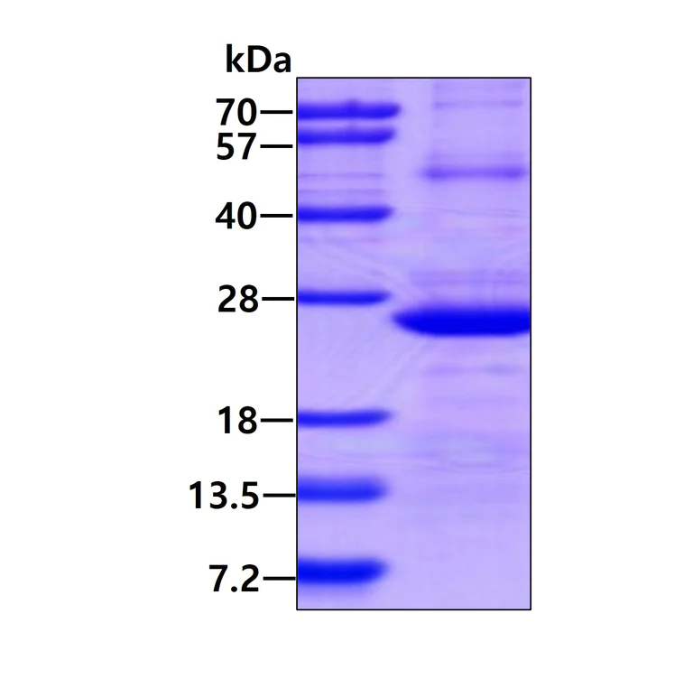 SDS-PAGE - Recombinant Human IFN-alpha-7 protein (denatured) (His tag N-Terminus) (AB139213)
