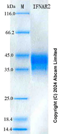 SDS-PAGE - Recombinant Human IFN alpha/beta R2 Protein Standard (His tag) (AB322092)