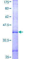 SDS-PAGE - Recombinant Human IFNA5 protein (AB158729), expandable thumbnail