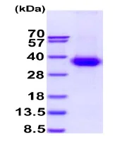 SDS-PAGE - Recombinant Human IFNGR1 protein (His tag C-Terminus) (AB235874)