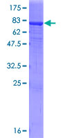 Recombinant Human IgA2 protein