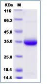 SDS-PAGE - Recombinant Human IgE protein (His tag) (AB276738)