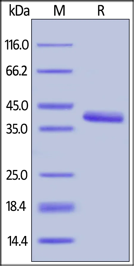 SDS-PAGE - Recombinant human IGF1 protein (Active) (AB155614)