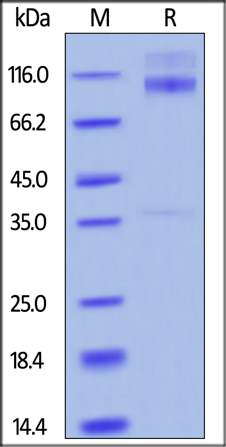 Recombinant human IGF1 Receptor protein