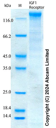 SDS-PAGE - Recombinant Human IGF1 Receptor Protein Standard (His tag) (AB322757)