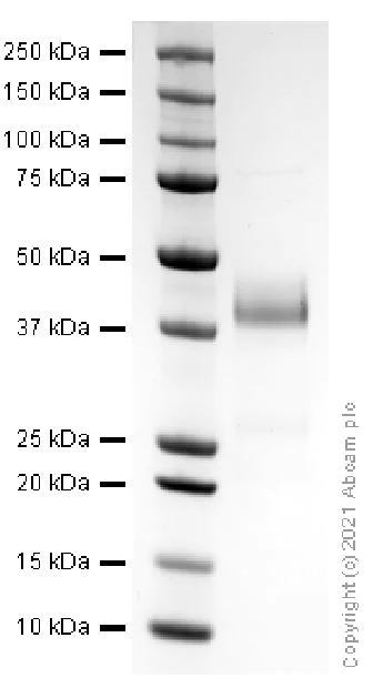 SDS-PAGE - Recombinant human IGFBP3 protein (Active) (AB280941)