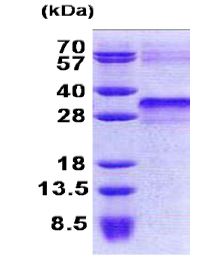 SDS-PAGE - Recombinant Human IGFBP6 protein (AB168094)