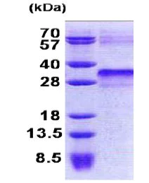SDS-PAGE - Recombinant Human IGFBP6 protein (His tag N-Terminus) (AB168094)