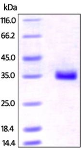 SDS-PAGE - Recombinant Human IGFBP7 protein (His tag) (AB219698), expandable thumbnail