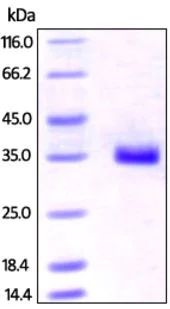 SDS-PAGE - Recombinant Human IGFBP7 protein (His tag) (AB219698)