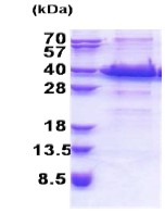 SDS-PAGE - Recombinant Human IGFBP7 protein (His tag N-Terminus) (AB174414)