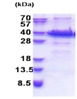 SDS-PAGE - Recombinant Human IGFBP7 protein (His tag N-Terminus) (AB174414)
