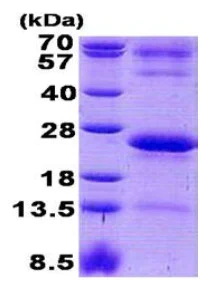 SDS-PAGE - Recombinant Human IGJ protein (AB140727)