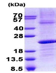 SDS-PAGE - Recombinant Human IGLL1 protein (denatured) (His tag N-Terminus) (AB140547)