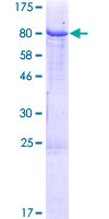 SDS-PAGE - Recombinant Human IgM protein (Tagged) (AB158748), expandable thumbnail