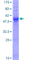 SDS-PAGE - Recombinant Human IGSF1/p120 protein (AB158752)