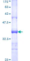 SDS-PAGE - Recombinant Human IGSF10 protein (GST tag N-Terminus) (AB166199)