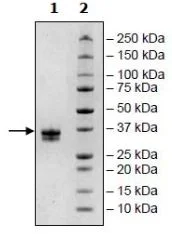 SDS-PAGE - Recombinant Human IGSF11 protein (Avi tag C-Terminus + His tag C-Terminus) (AB271788)