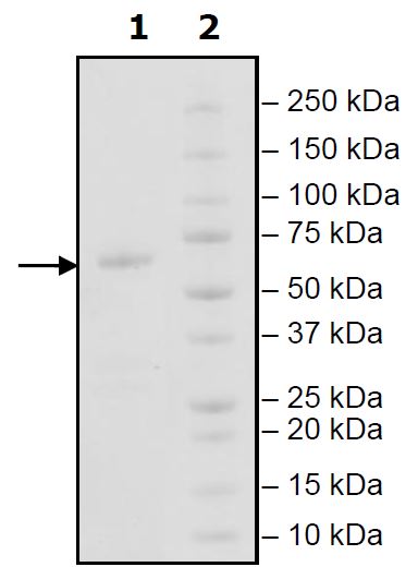 Recombinant Human IGSF11 protein (Tagged)