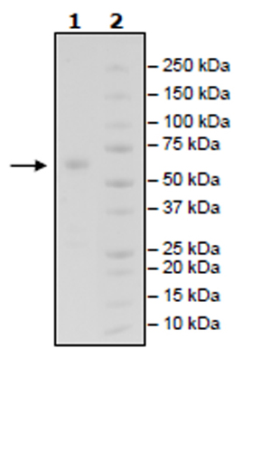 SDS-PAGE - Recombinant Human IGSF11 protein (Tagged) (Biotin) (AB271790)