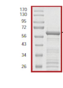 SDS-PAGE - Recombinant Human IKB alpha protein (AB59981)