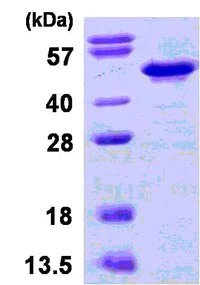 SDS-PAGE - Recombinant Human IKB beta protein (His tag N-Terminus) (AB123184)