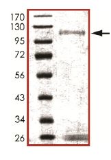 SDS-PAGE - Recombinant human IKK alpha protein (Active) (AB102103), expandable thumbnail