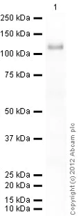 Western blot - Recombinant human IKK alpha protein (Active) (AB102103)