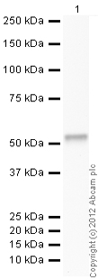Western blot - Recombinant Human IKK beta protein (AB114243), expandable thumbnail