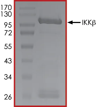 SDS-PAGE - Recombinant human IKK beta protein (Active) (AB177584)