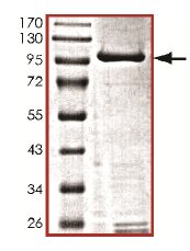 SDS-PAGE - Recombinant human IKK beta protein (Active) (AB177584), expandable thumbnail