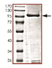 SDS-PAGE - Recombinant human IKK beta protein (Active) (AB177584)