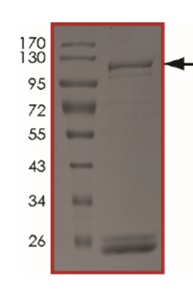 Recombinant human IKK beta protein (Active)