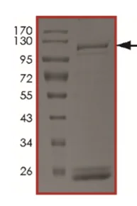 SDS-PAGE - Recombinant human IKK beta protein (Active) (AB217831)