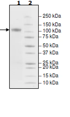 SDS-PAGE - Recombinant human IKK beta protein (Active) (AB271550)