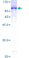 Recombinant Human IKZF3 protein