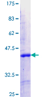 SDS-PAGE - Recombinant Human IKZF5 protein (AB163827), expandable thumbnail